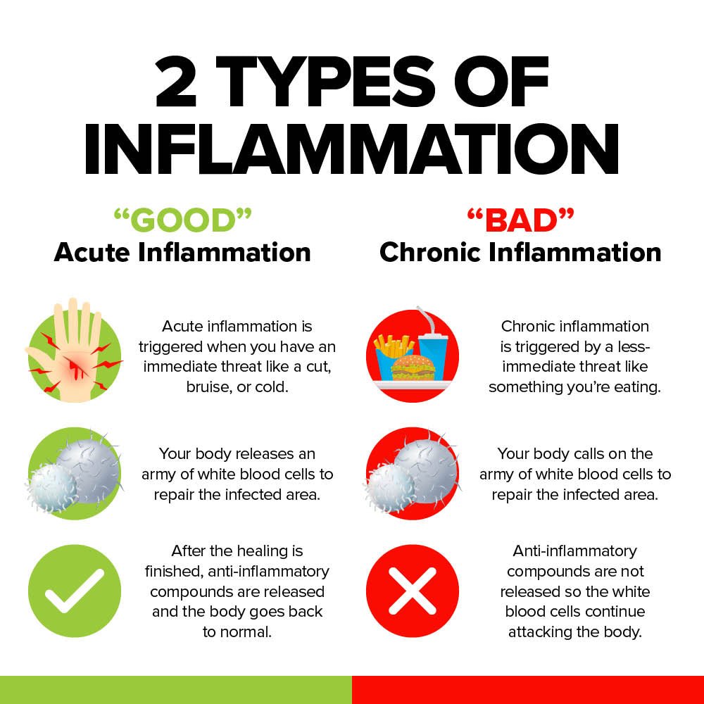 Cyactiv Inflammation Support pentru Suport Inflamator Sistemic - Cerule - 60 capsule - Protein4Life